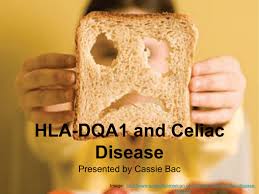 HLA-DQA1 Disease.