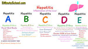 Five types of Hepatitis 2022 Best Five types of Hepatitis