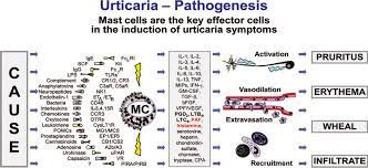 Pathophysiological concepts of urticaria