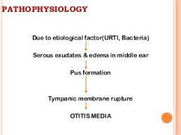 Pathophysiology of Otitis Media.