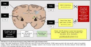 Recurrent brain ischemia.