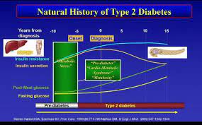 History of type 2 diabetes.