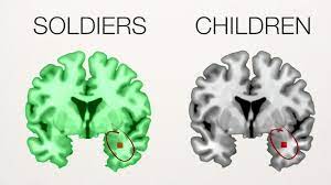 PTSD on children in war.