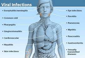 Treatment of a viral infection.